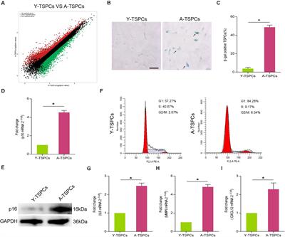 Inhibition of JAK-STAT Signaling Pathway Alleviates Age-Related Phenotypes in Tendon Stem/Progenitor Cells